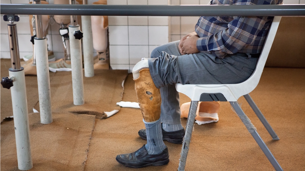 This patient lost his leg in a mine explosion; this is already his third prosthesis [Arianna Pagani/Al Jazeera]