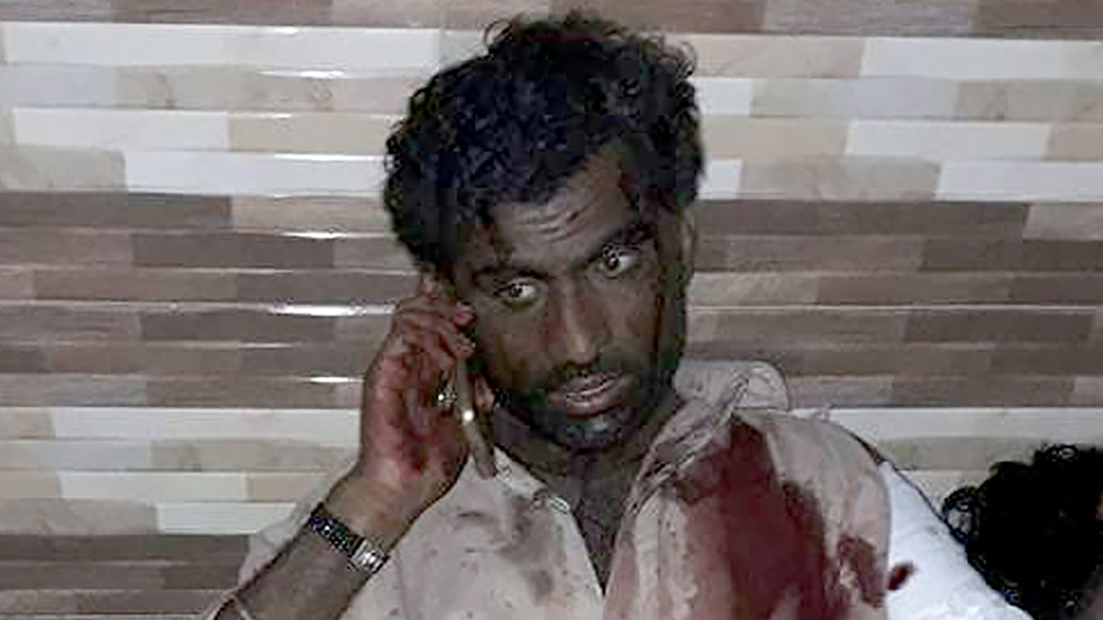 An injured Pakistani blast victim talks on mobile phone at a local hospital after the explosion [AFP]