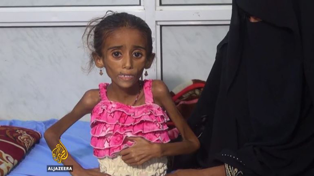 Millions of people in Yemen are on the brink of starvation [Al Jazeera]