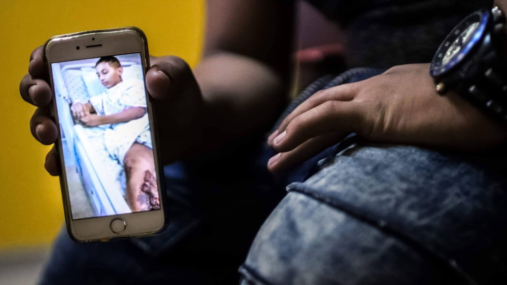 Issa holding up a camera photo of him when he was at the hospital. It shows his leg after developing gangrene and his arm handcuffed to the hospital bed at the Hadassah hospital in Jerusalem [Jaclynn Ashly/Al Jazeera]