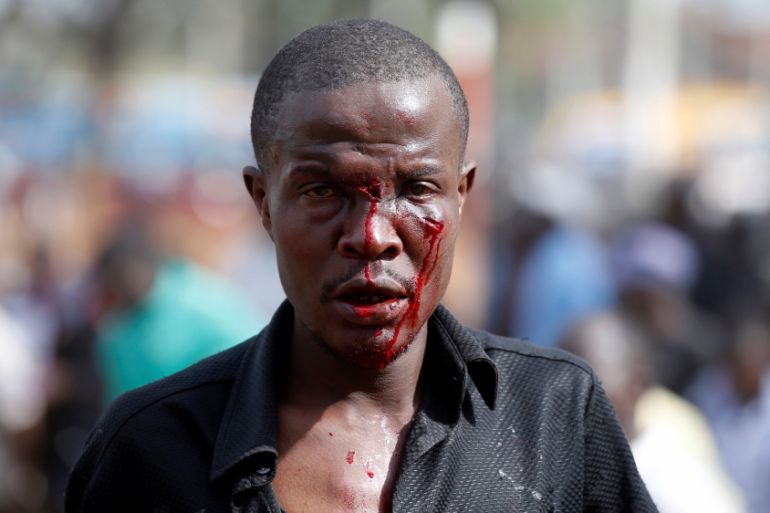 An injured supporter of Kenyan opposition National Super Alliance (NASA) coalition walks after he clams he was stabbed during clashes in Nairobi