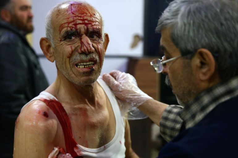 A wounded man is seen in a hospital in Douma after an airstrike in the rebel-held besieged town of Douma
