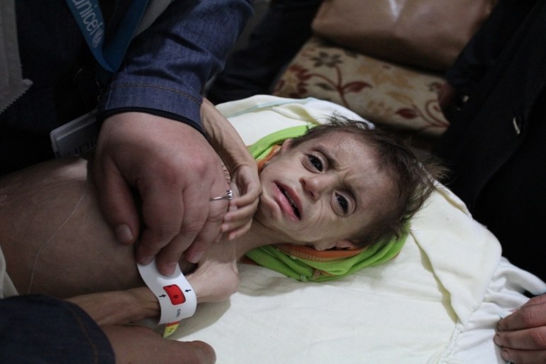 Eastern Ghouta malnutrition