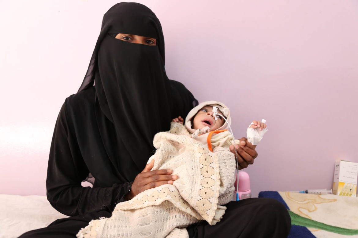 The crisis in Yemen is brutal on children and babies, many of whom are dying of starvation and acute malnutrition. Amani is a five-month-old baby weighing only 2 kgs. Here she is in the malnutrition