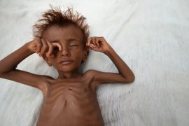 Yemen Famine Reuters