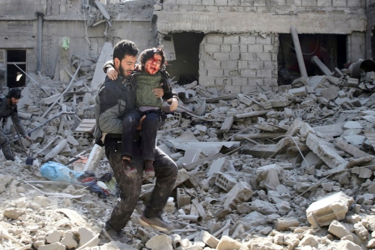 Ghouta injury Halim S. op-ed photo - REUTERS