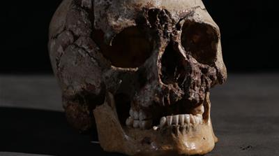 DNA had been preserved inside Cheddar Man's skull [University College London/Channel 4]