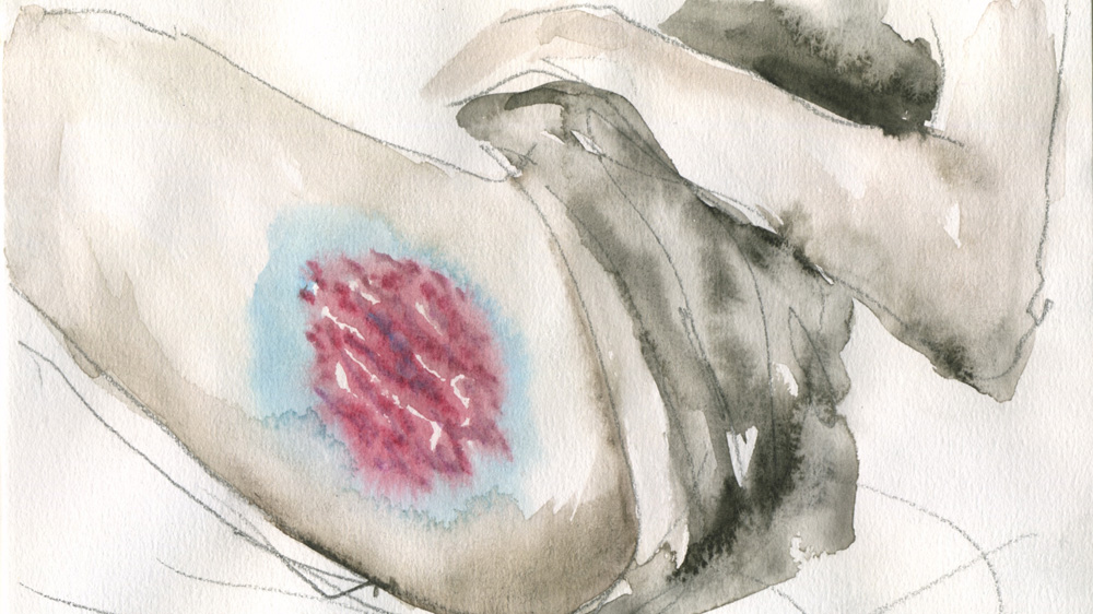One of Potemkina's watercolour paintings depicting marks from physical violence [Courtesy: Anastasia Potemkina]