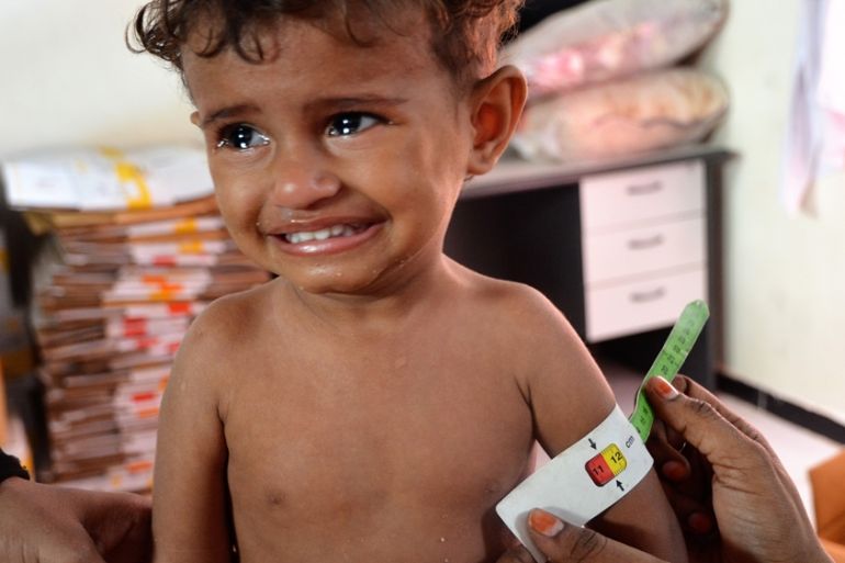Malnourished Yemeni girl
