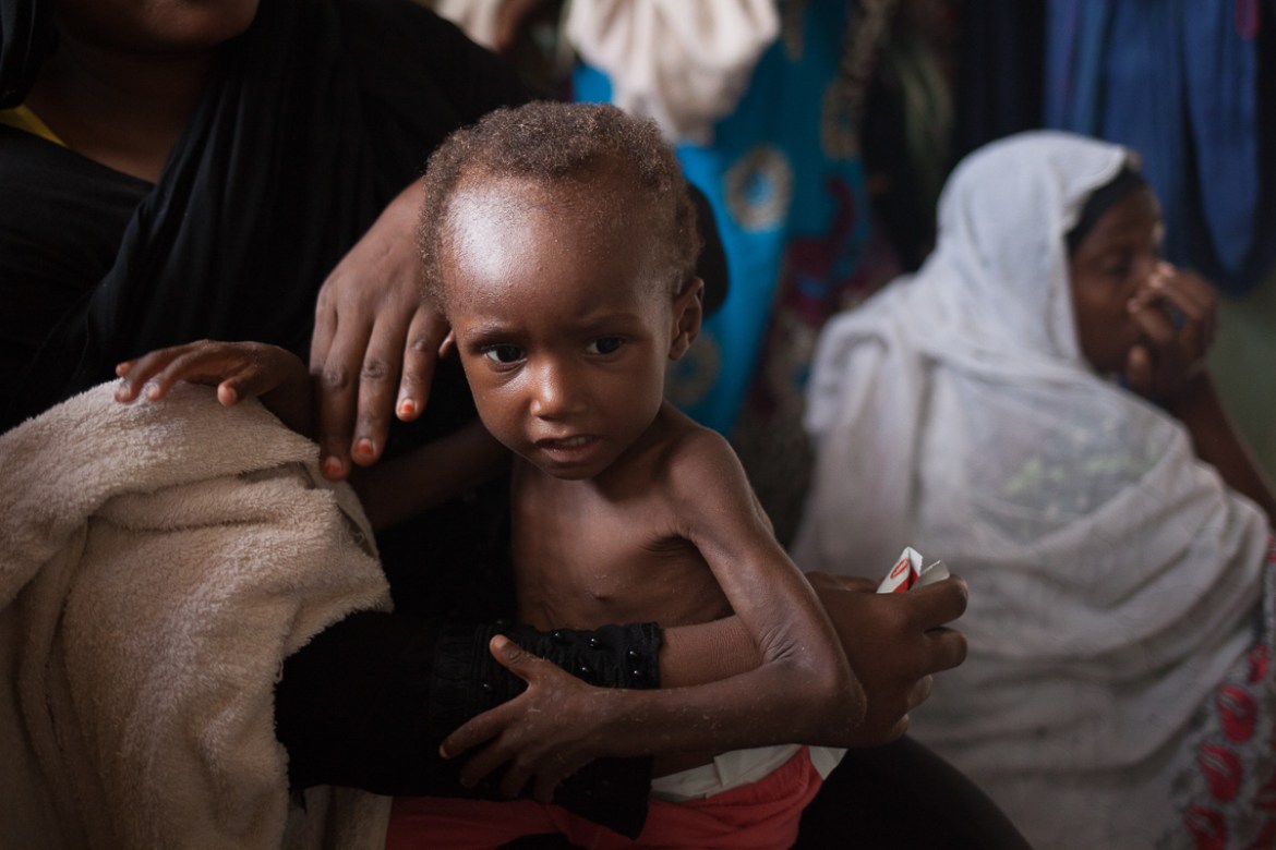 At the Ndjari neighbourhood health centre, Awa Adan, 2 years old, has been sick for 6 months. Her mother Halila Hanoor, 25 years old says : "I myself am sick because I am disturbed by my child''s condi