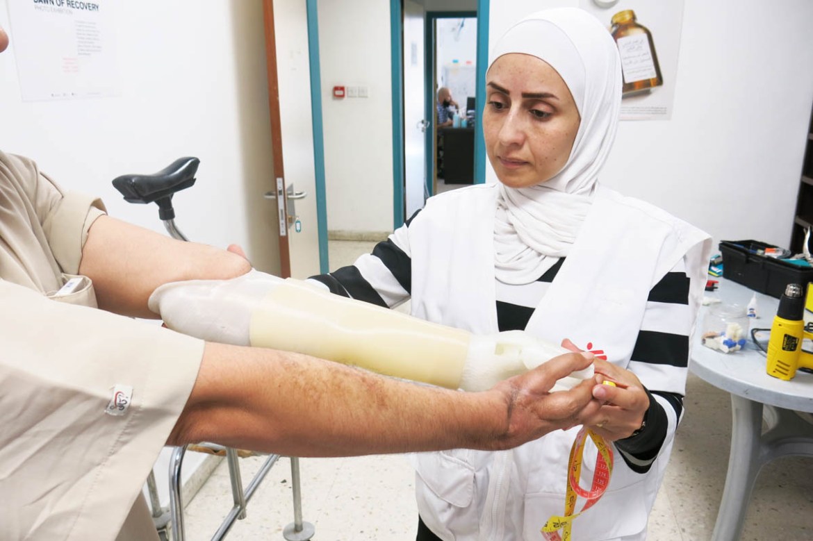 Abu Mohammad* receives his final prosthetics two weeks after modifications were applied on the initial test device. In light of a nerve injury and amputated fingers on his other limb, the patient rece