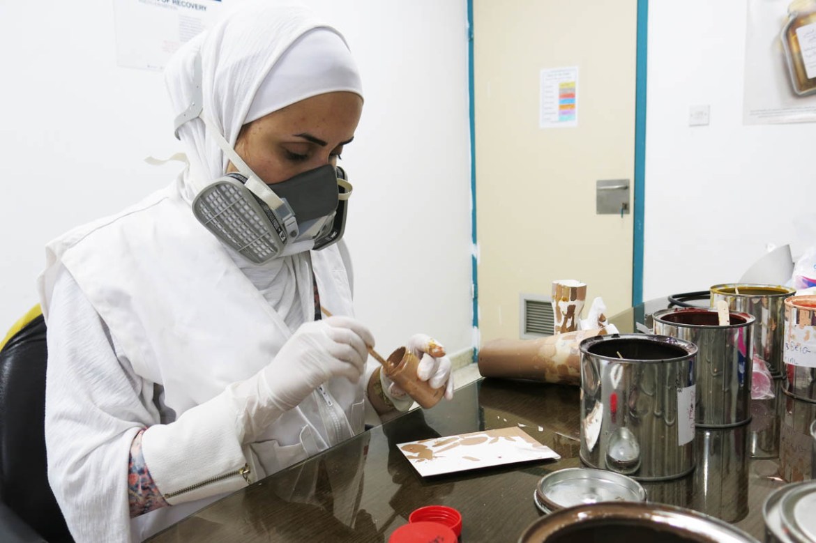 MSF 3D Project Supervisor Samar Ismail searches for a suitable skin tone based on the patient’s complexion to paint the prosthetics. Post processing on the prosthesis also includes smoothing its insid