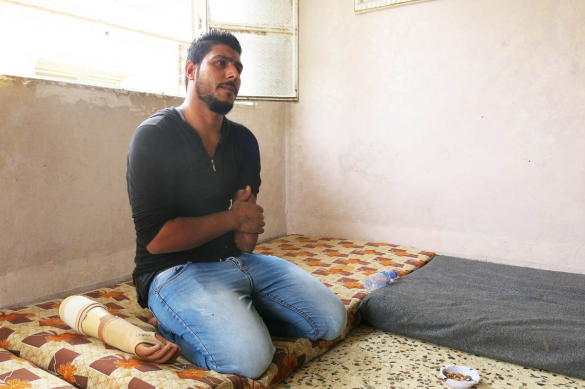 Abdulkareem**, 23, from Homs, Syria. Two months in the Syrian conflict, he says he was home when a plane dropped a bomb. He was injured but couldn’t realize where exactly. His arm was hanging with onl