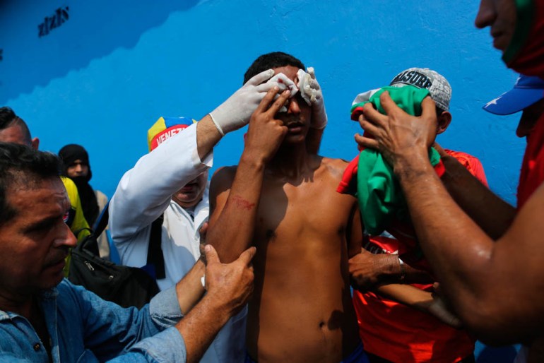 A demonstrators is given first aid after he was injured in the face during clashes with the Bolivarian National Guard in Urena, Venezuela, near the border with Colombia, Saturday, Feb. 23, 2019. Venez
