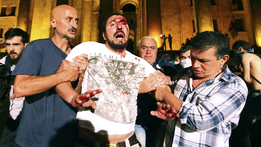Opposition demonstrators help a wounded man during a protest at Georgian Parliament to call for the resignation of the speaker of the Georgian Parliament in Tbilisi, Georgia, Friday, June 21, 2019. Po