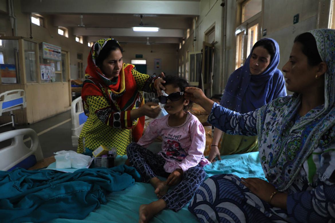 Family membersAttendMunifaNazir 6, years old girl from safakadal  area at SMHS hospital in Srinagar on August 17, she was hurt in right eye after paramilitary forces targeted her with a sling shot in