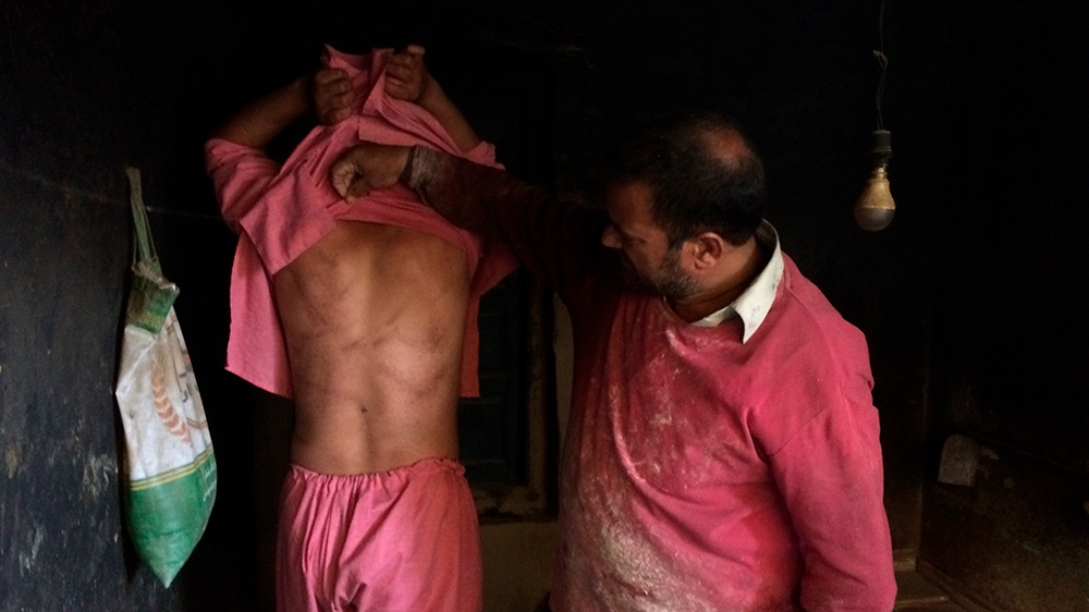 In this Monday, Aug. 26, 2019, photo, a Kashmiri baker Sonaullah Sofi lifts the shirt from his son's back to show torture marks allegedly caused by Indian army soldiers at their bakery in southern vil