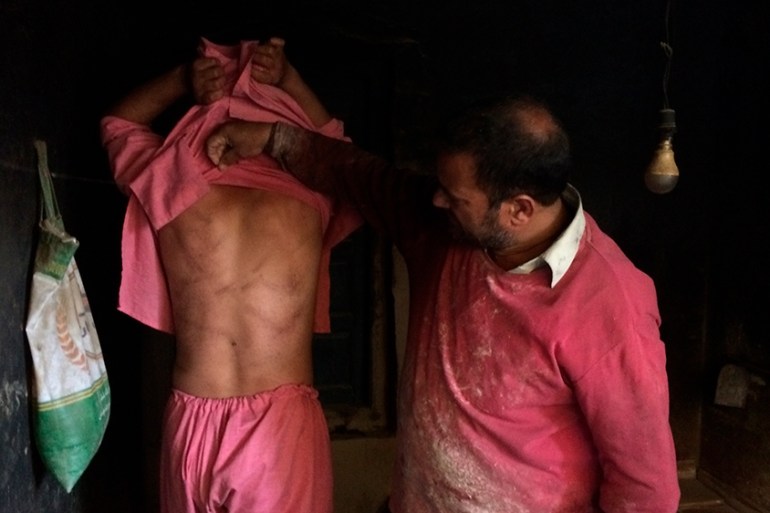 In this Monday, Aug. 26, 2019, photo, a Kashmiri baker Sonaullah Sofi lifts the shirt from his son''s back to show torture marks allegedly caused by Indian army soldiers at their bakery in southern vil