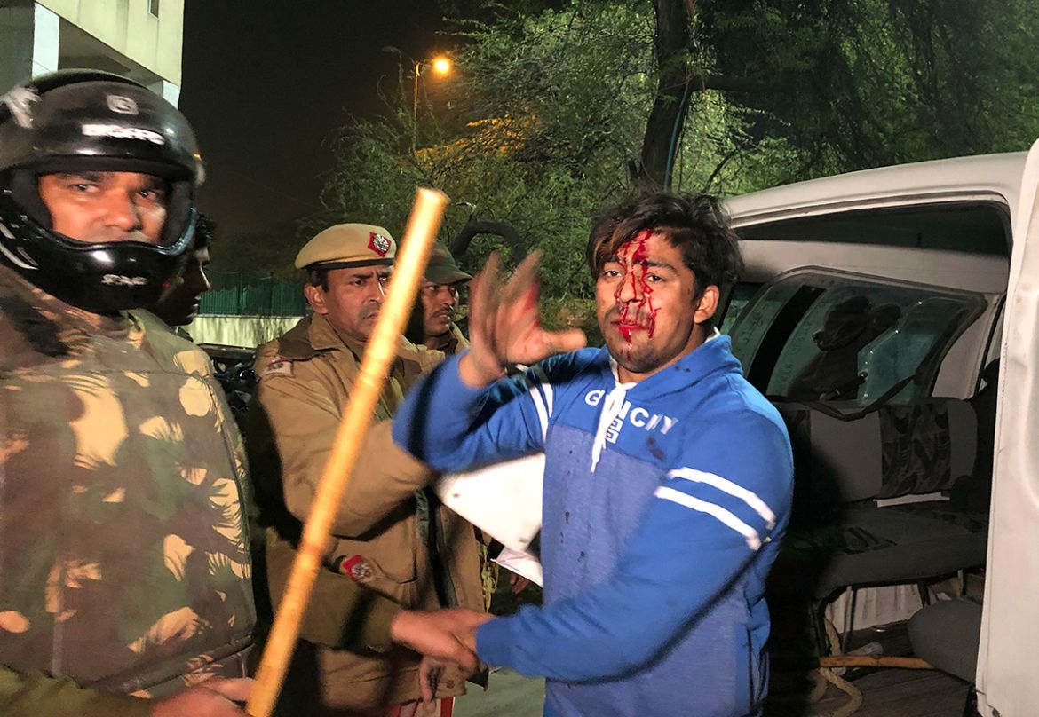 Policemen detain an injured student outside Jamia Millia Islamia university during a protest against Citizenship Amendment Act in New Delhi, India, Sunday, Dec. 15, 2019. Protests have been continuing