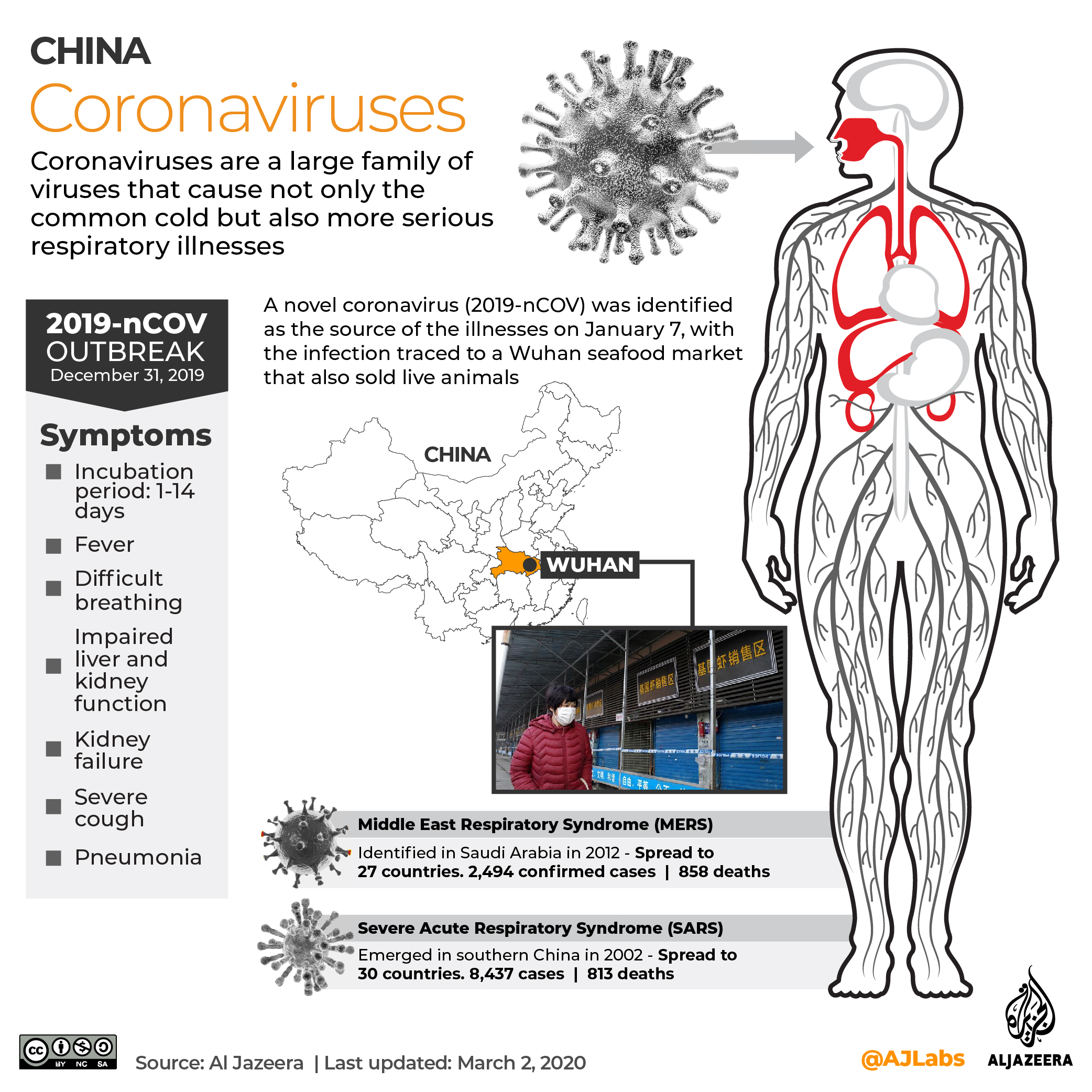 INTERACTIVE: Coronavirus 2019 - March 2, 2020 update