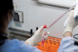 A scientist works in the lab of Linqi Zhang on research into novel coronavirus disease (COVID-19) antibodies for possible use in a drug at Tsinghua University in Beijing