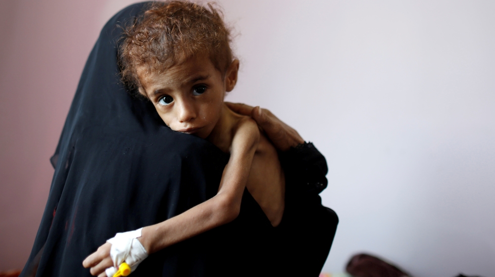 A woman holds a malnourished boy in a malnutrition treatment centre at the al-Sabeen hospital in Sanaa, Yemen October 6, 2018. REUTERS/Khaled Abdullah TPX IMAGES OF THE DAY