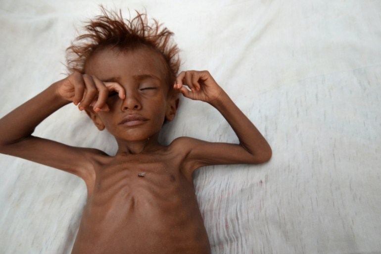 The Wider Image: Risk of famine looms in Yemen
