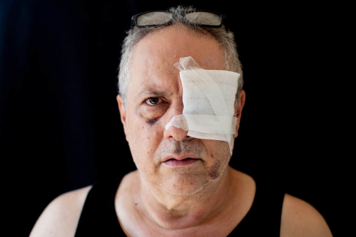 Tony Helou, 63, unemployed, who got injured at his apartment during the Aug. 4 explosion that killed more than 170 people, injured thousands and caused widespread destruction, poses for a photograph a