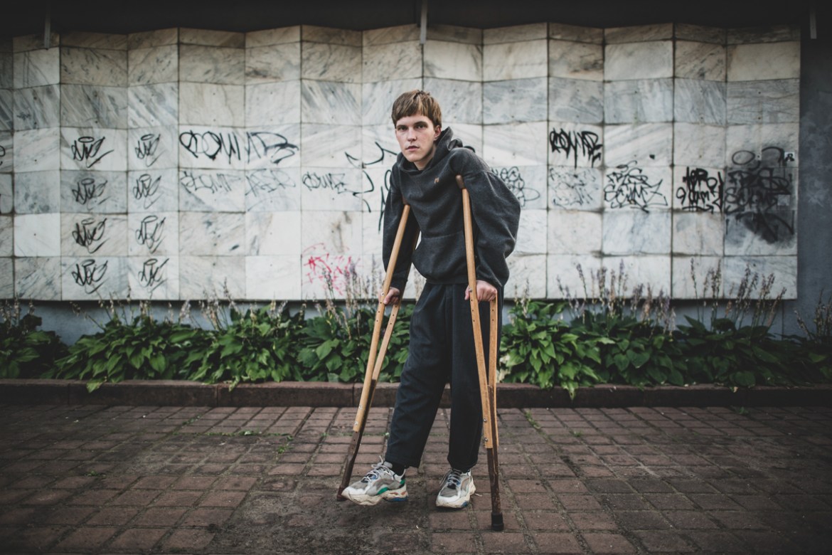 Alexander Laubert, 18, a student poses for a photo Tuesday, Aug. 18, 2020 on crutches due to a broken knee after being beaten by police during a protest in Minsk, Belarus. Wary at first, Laubert event