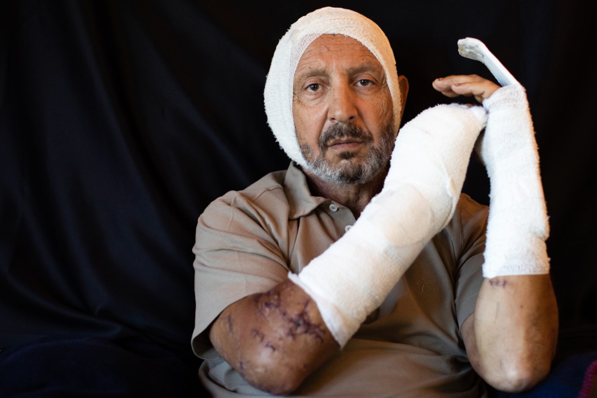 Rainier Jreissati, 63, businessman, who got injured at his home during the Aug. 4 explosion that killed more than 170 people, injured thousands and caused widespread destruction, poses for a photograp
