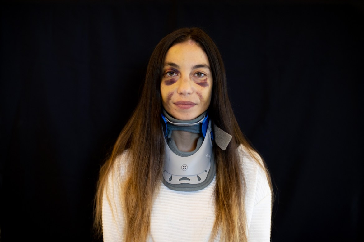 Clara Chammas, a psychologist and a health coach, who got injured at her apartment during the Aug. 4 explosion that killed more than 170 people, injured thousands and caused widespread destruction, po