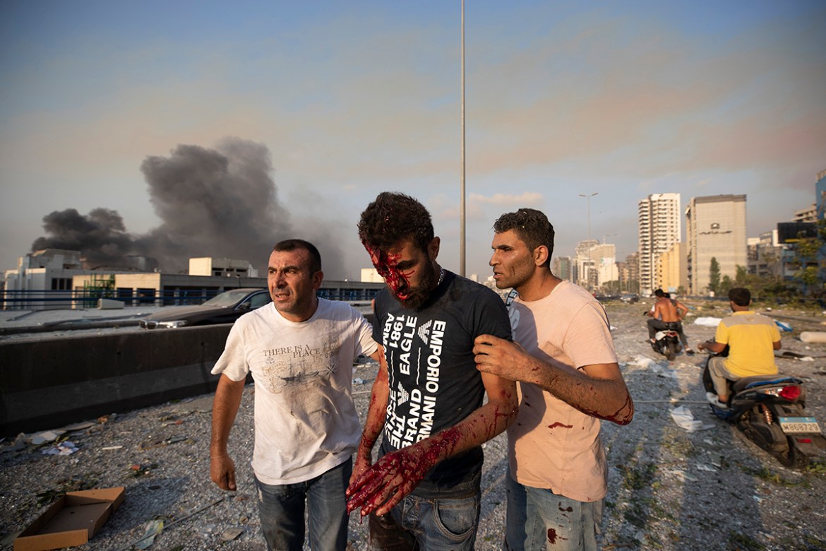 People help a man who was wounded in a massive explosion in Beirut, Lebanon, Tuesday, Aug. 4, 2020. Massive explosions rocked downtown Beirut on Tuesday, flattening much of the port, damaging building