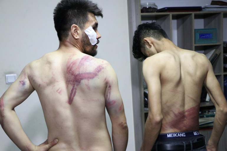 Jornalistas afegãos mostram seus ferimentos após serem espancados pelo Taleban em Cabul [Arquivo: Etilaatroz via Reuters]