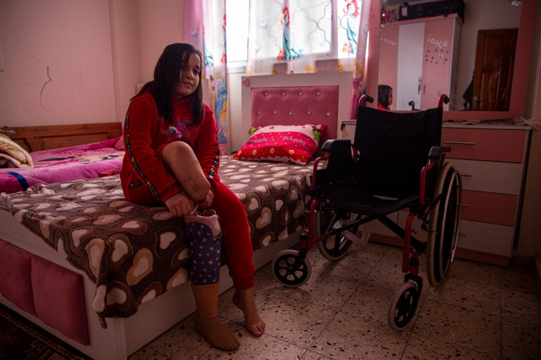 Farah Isleem, 12 years old, wears her prosthetic leg after she lost her leg in an Israeli bombing to their home. 