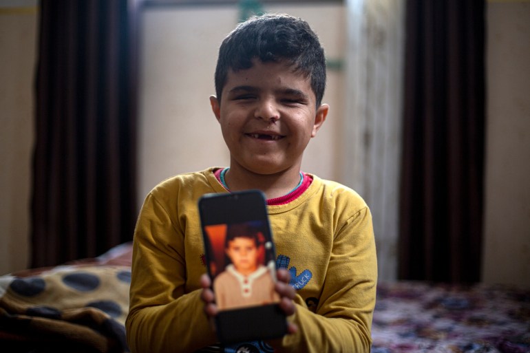 محمد شعبان، 7 ساله، قبل از اینکه چشمانش را از دست بدهد، عکس را نگه می دارد. [File: Mohammed Salem/ Al Jazeera]