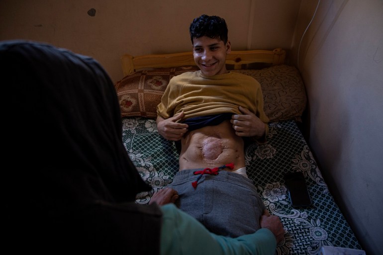 محمود نعیم، 18 ساله، پس از اصابت ترکش به پشتش، فلج شده و بر روی تخت خود دراز کشیده است. 