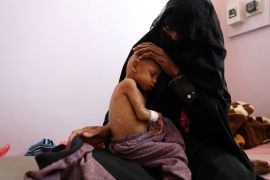A malnourished toddler is seen with his mother in Yemen
