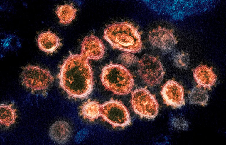 electron microscope image provided by the National Institute of Allergy and Infectious Diseases - Rocky Mountain Laboratories shows SARS-CoV-2 virus particles causing COVID-19 isolated from a patient in the US, emerging from the surface of cells in a laboratory cultivated.