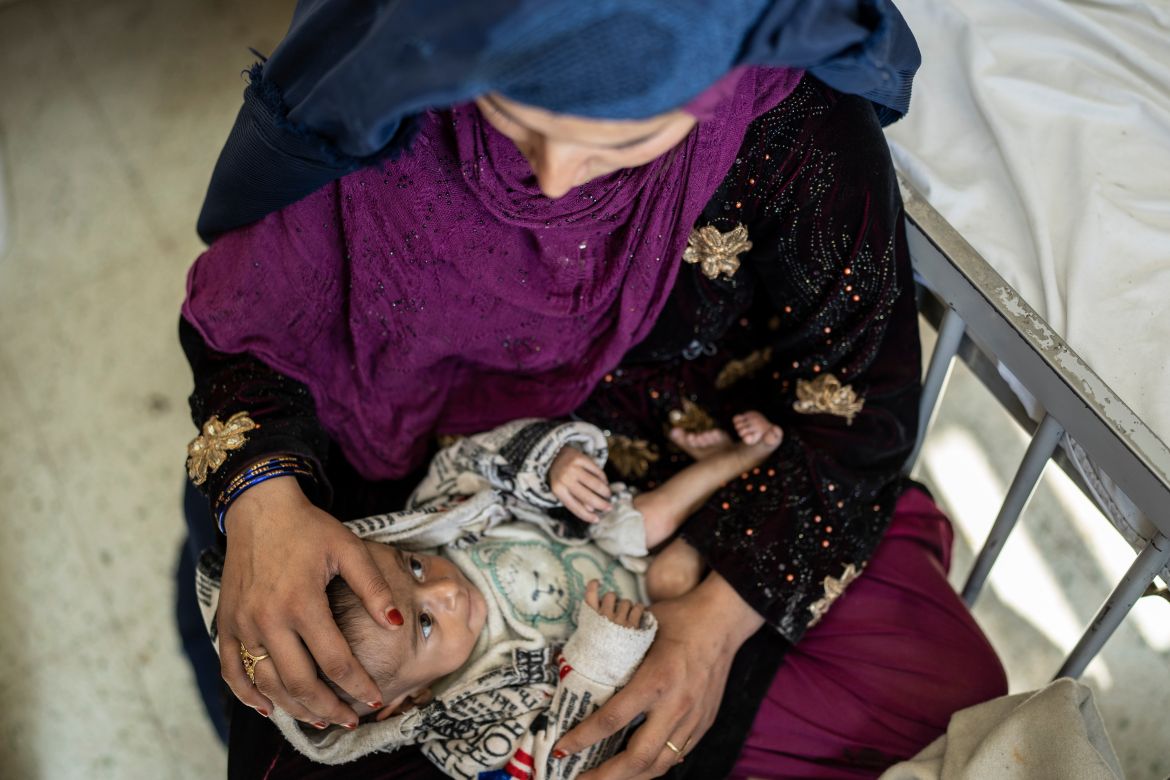 A woman holds her 4-month-old baby at Children's Hospital in Kabul