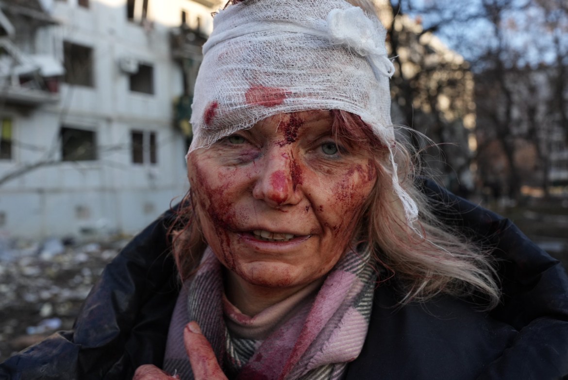 A wounded woman is seen as Russian airstrike damages an apartment complex outside of Kharkiv, Ukraine on February 24, 2022.