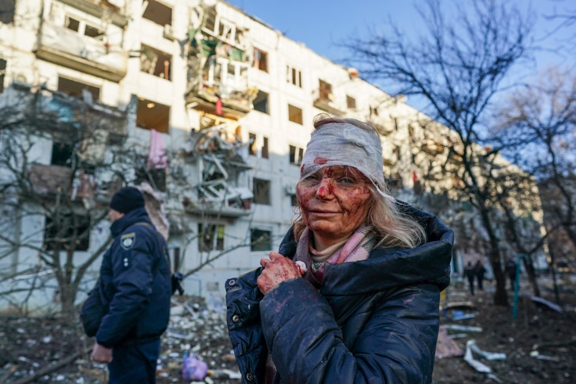A wounded woman is seen after an airstrike damaged an apartment complex in city of Chuhuiv, Kharkiv Oblast