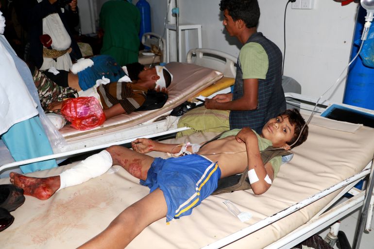 An Injured boy lies on a hospital bed at a local Al Jomhouri hospital after an air strikes killed civilians