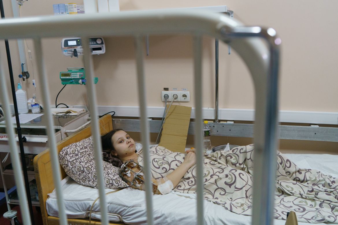 Masha Feshchenko,15, resting in Zaporizhzhia
