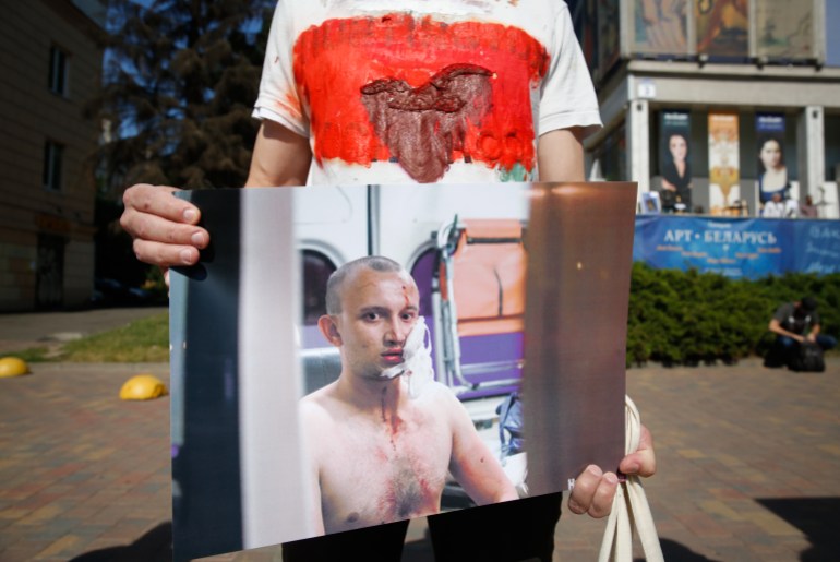 A Belarusian man holds pictures of a person reportedly beaten by the police in a detention center 
