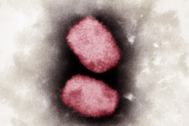 Colored electron-microscopic capture of the monkeypox virus