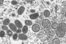 An electron microscopic image shows the oval-shaped monkeypox virus particles [File: Reuters]