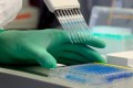 An employee at the Institute of Virology at the Technical University of Munich (TUM) pipettes a protein detection approach (ELISA) in a laboratory in Munich