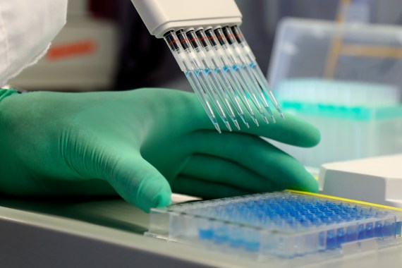 An employee at the Institute of Virology at the Technical University of Munich (TUM) pipettes a protein detection approach (ELISA) in a laboratory in Munich