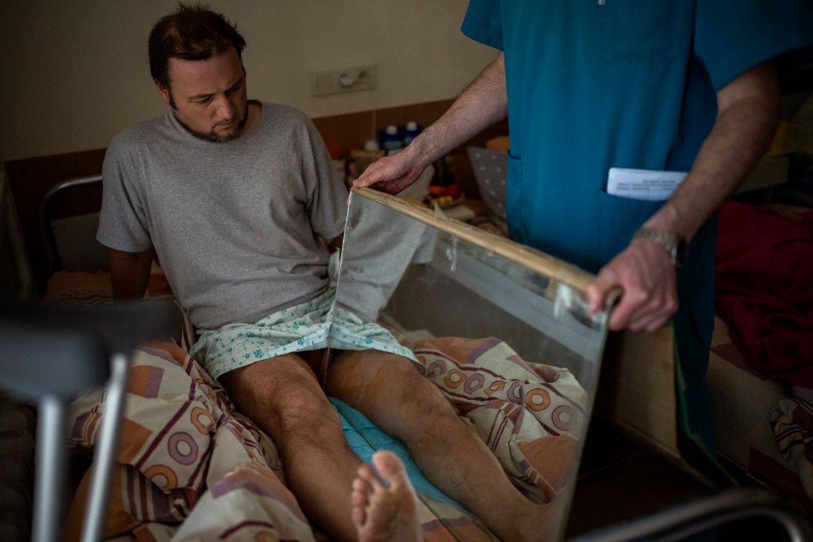 Sasha Horokhivskyi, 38, performs mirror therapy to mitigate phantom pains at a public hospital in Kyiv