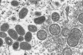 Monkeypox virus seen through a microscope.
